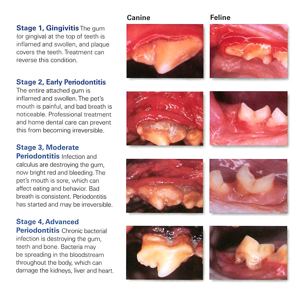 Periodontal disease